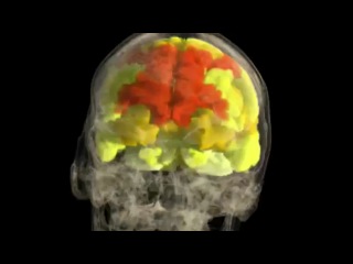 female orgasm - filming brain activity